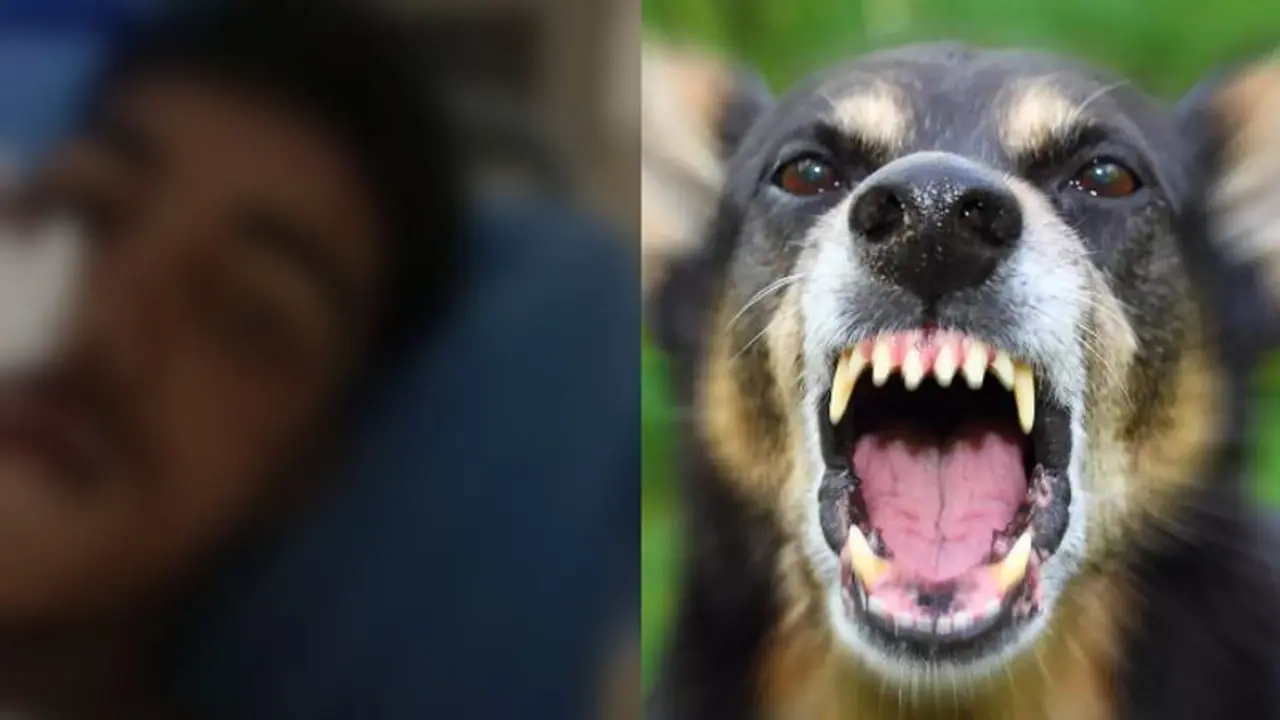 Kerala: 16 year old suffers severe injuries after being chased by stray dogs 