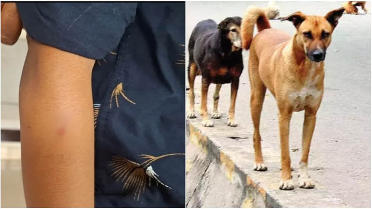 വീട്ടില് ഉറങ്ങിക്കിടന്ന 10 വയസുകാരനെ തെരുവുനായ കടിച്ചു വീട്ടില് ഉറങ്ങിക്കിടന്ന 10 വയസുകാരനെ തെരുവുനായ കടിച്ചു