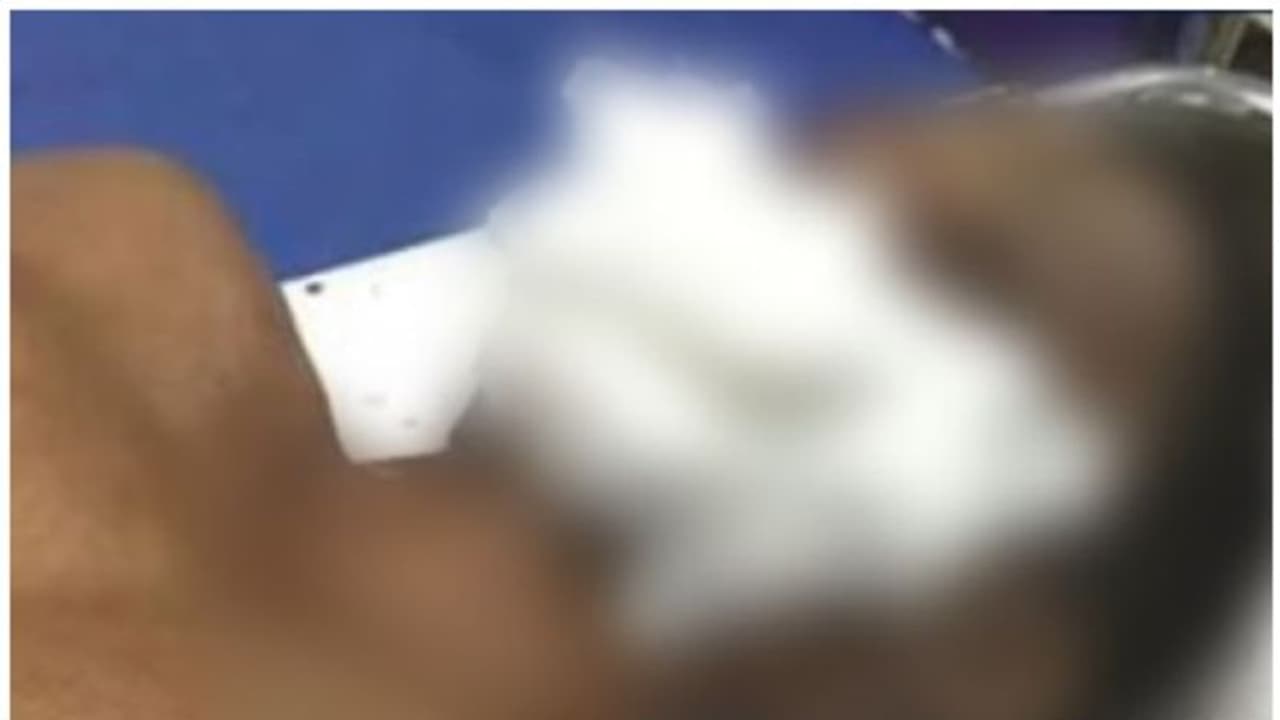 നായപ്പേടിയിൽ നാട്; കാസർകോട് തെരുവുനായ ആക്രമണം; മധ്യവയസ്കന്റെ കീഴ്ചുണ്ട് കടിച്ചെടുത്തു നായപ്പേടിയിൽ നാട്; കാസർകോട് തെരുവുനായ ആക്രമണം; മധ്യവയസ്കന്റെ കീഴ്ചുണ്ട് കടിച്ചെടുത്തു