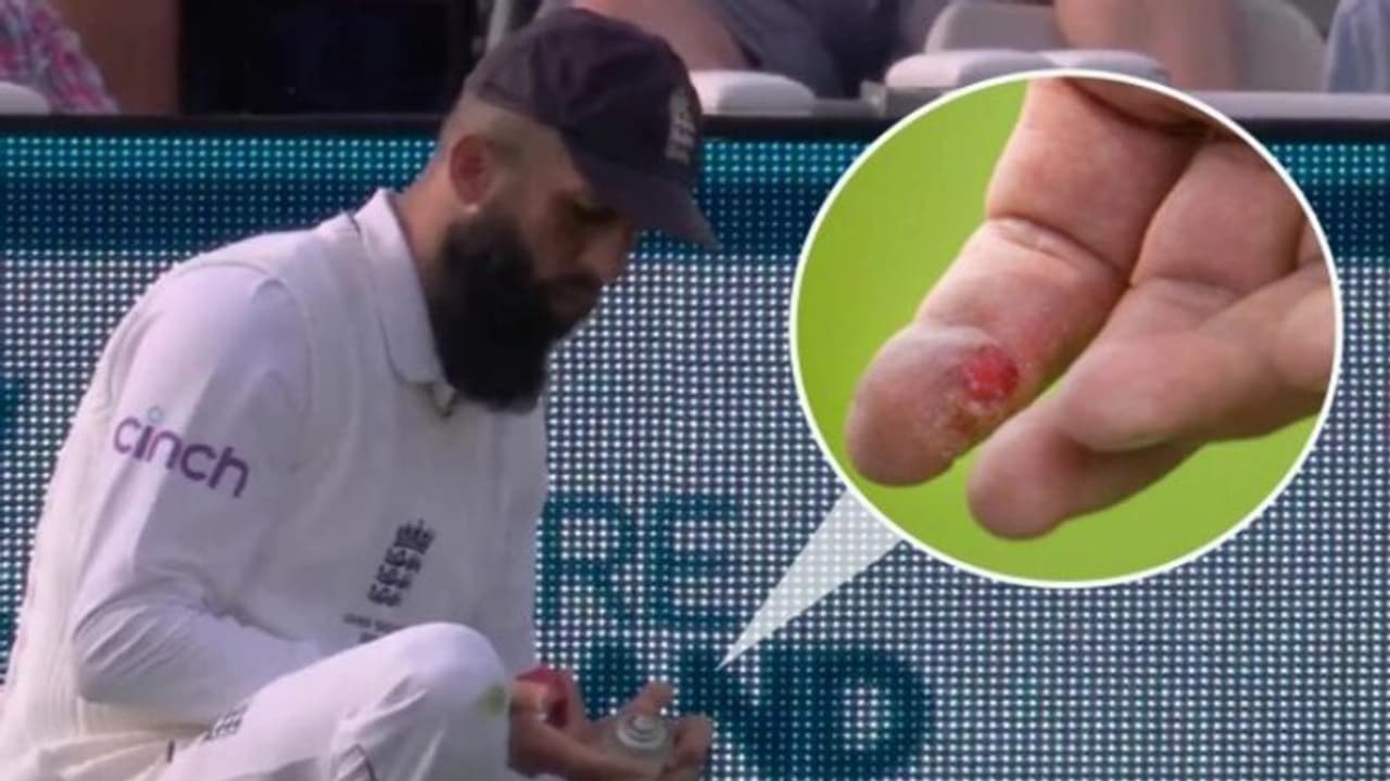 கொஞ்சம் கூட மனசாட்சி வேண்டாமா? காயத்துக்கு மருந்து கூட போடக் கூடாதா? ஐசிசியை விளாசிய பிராட் ஹாக்! கொஞ்சம் கூட மனசாட்சி வேண்டாமா? காயத்துக்கு மருந்து கூட போடக் கூடாதா? ஐசிசியை விளாசிய பிராட் ஹாக்!