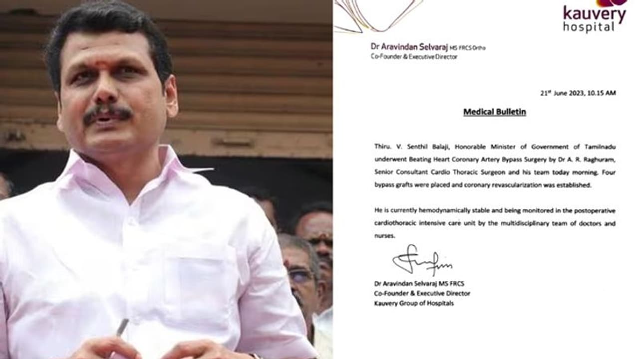 5 மணிநேரம் அறுவை சிகிச்சைக்கு பிறகு செந்தில் பாலாஜி எப்படி இருக்கிறார்? காவேரி மருத்துவமனை பரபரப்பு அறிக்கை.!