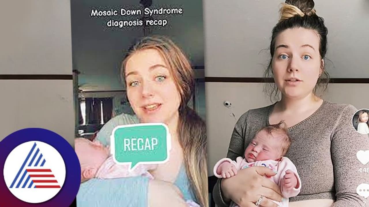 ಮೂರು ಮಕ್ಕಳಾದ್ಮೇಲೆ ತಾಯಿಗೆ Down Syndrome ಪತ್ತೆ, ಮಕ್ಕಳಿಗೆ? ಏನಿದು ರೋಗ?