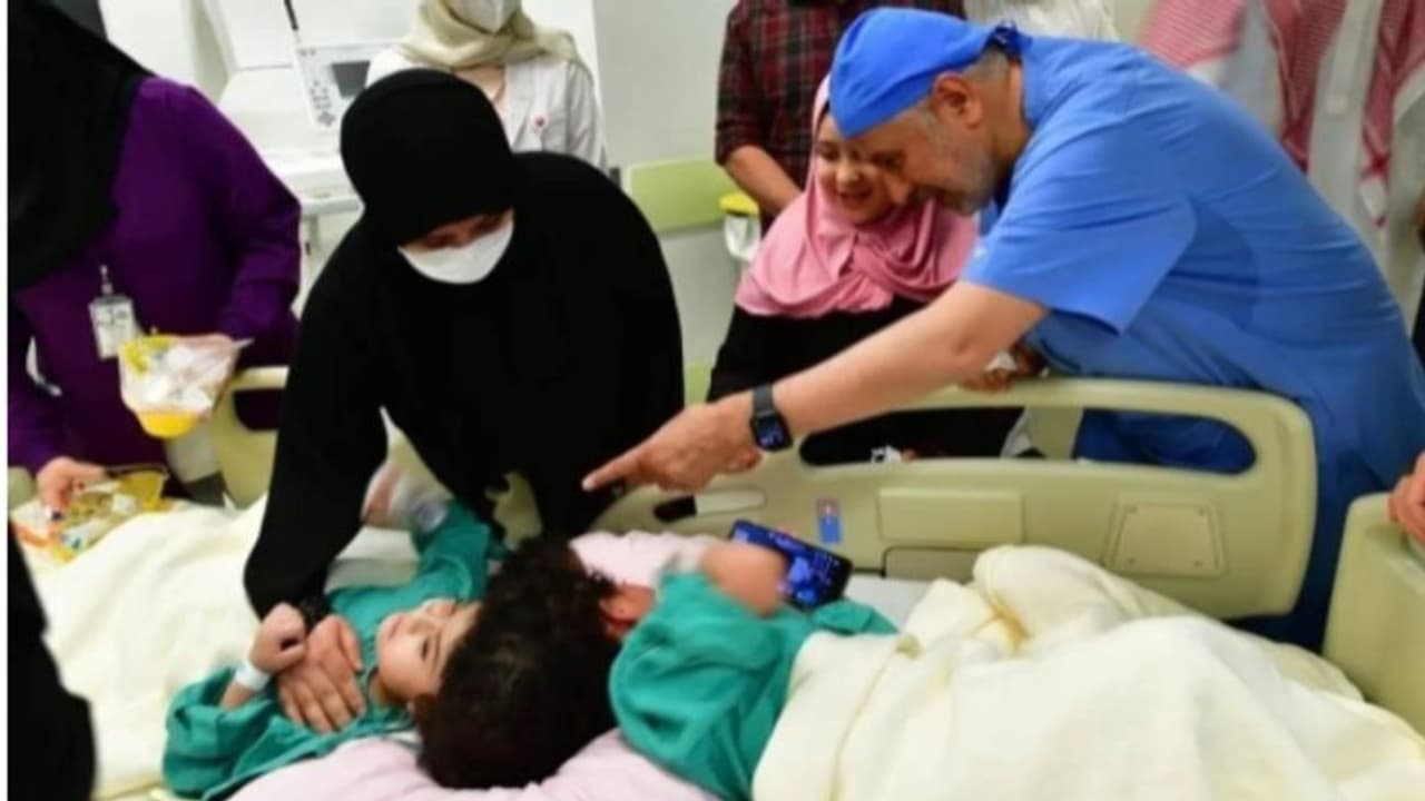 17 മണിക്കൂറുകള് നീണ്ട സങ്കീര്ണമായ ശസ്ത്രക്രിയ വിജയംകണ്ടു; സല്മയും സാറയും ഇനി രണ്ട് രണ്ടായി ജീവിക്കും 17 മണിക്കൂറുകള് നീണ്ട സങ്കീര്ണമായ ശസ്ത്രക്രിയ വിജയംകണ്ടു; സല്മയും സാറയും ഇനി രണ്ട് രണ്ടായി ജീവിക്കും