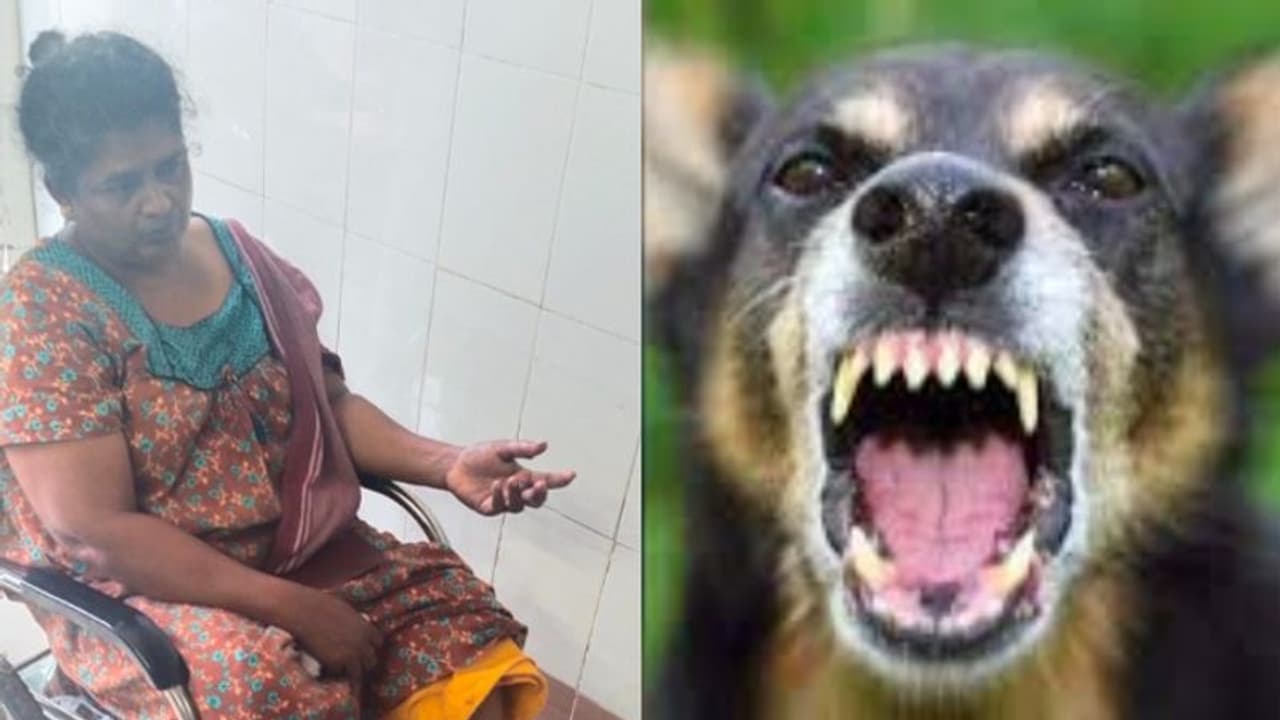 വീട്ടുമുറ്റത്തുനിന്ന വീട്ടമ്മയുടെ കൈവിരലും കാലും കഴുത്തും കടിച്ചുപറിച്ചു; തെരുവുനായക്ക് പേവിഷബാധ സംശയം വീട്ടുമുറ്റത്തുനിന്ന വീട്ടമ്മയുടെ കൈവിരലും കാലും കഴുത്തും കടിച്ചുപറിച്ചു; തെരുവുനായക്ക് പേവിഷബാധ സംശയം