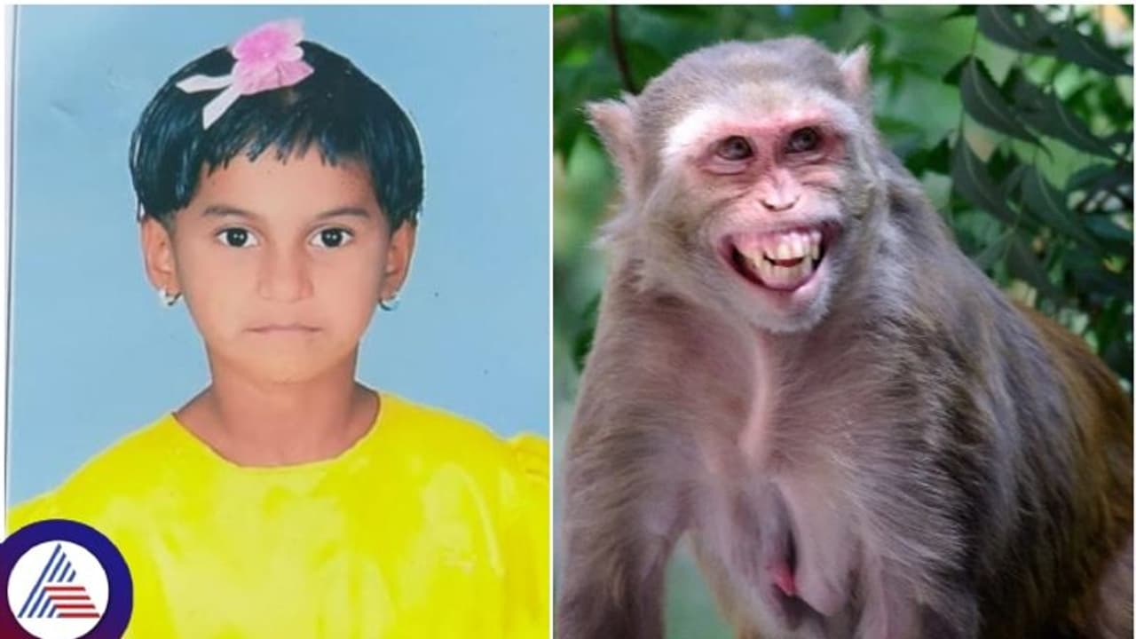 ಬಾಲಕಿ ಮೇಲೆ ದಾಳಿ ಮಾಡಿದ ಕೋತಿ: ಕಾಲಿಗೆ ಗಂಭೀರ ಗಾಯ