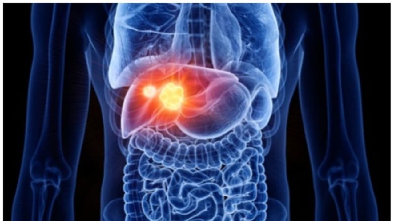 കരൾ രോ​ഗങ്ങൾ അകറ്റുന്നതിന് ഡയറ്റിൽ ഉൾപ്പെടുത്താം നാല് ഭക്ഷണങ്ങൾ