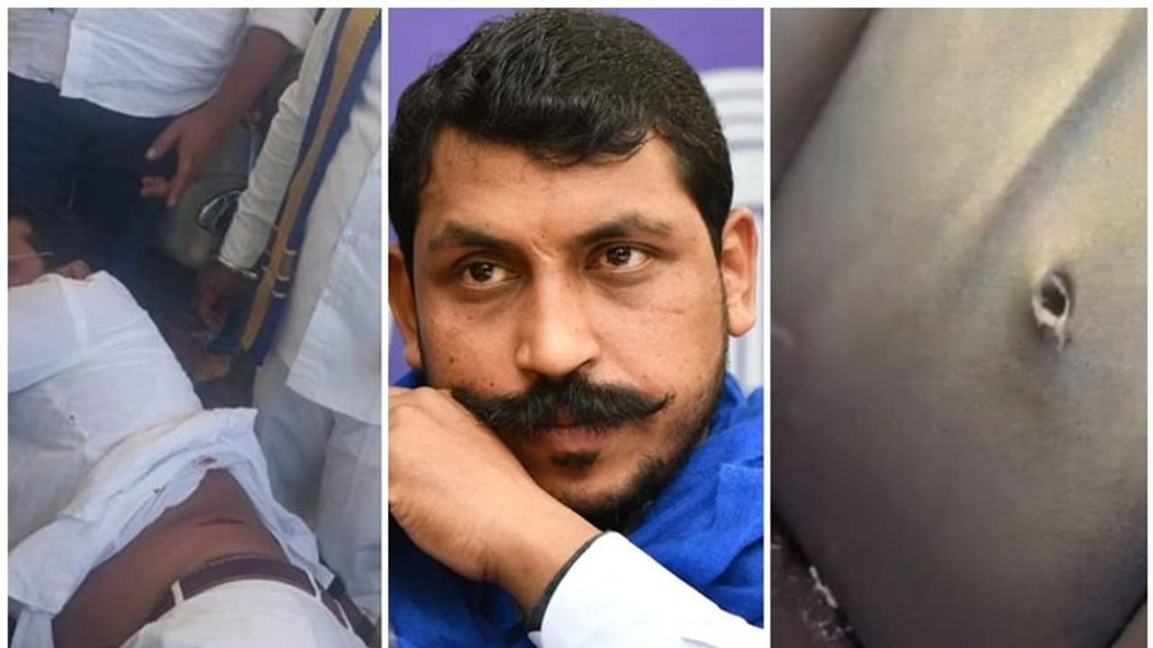 ಭೀಮ್ ಆರ್ಮಿ ಚೀಫ್ ಚಂದ್ರಶೇಖರ್ ಆಜಾದ್ ಮೇಲೆ ಗುಂಡಿನ ದಾಳಿ! ಭೀಮ್ ಆರ್ಮಿ ಚೀಫ್ ಚಂದ್ರಶೇಖರ್ ಆಜಾದ್ ಮೇಲೆ ಗುಂಡಿನ ದಾಳಿ!