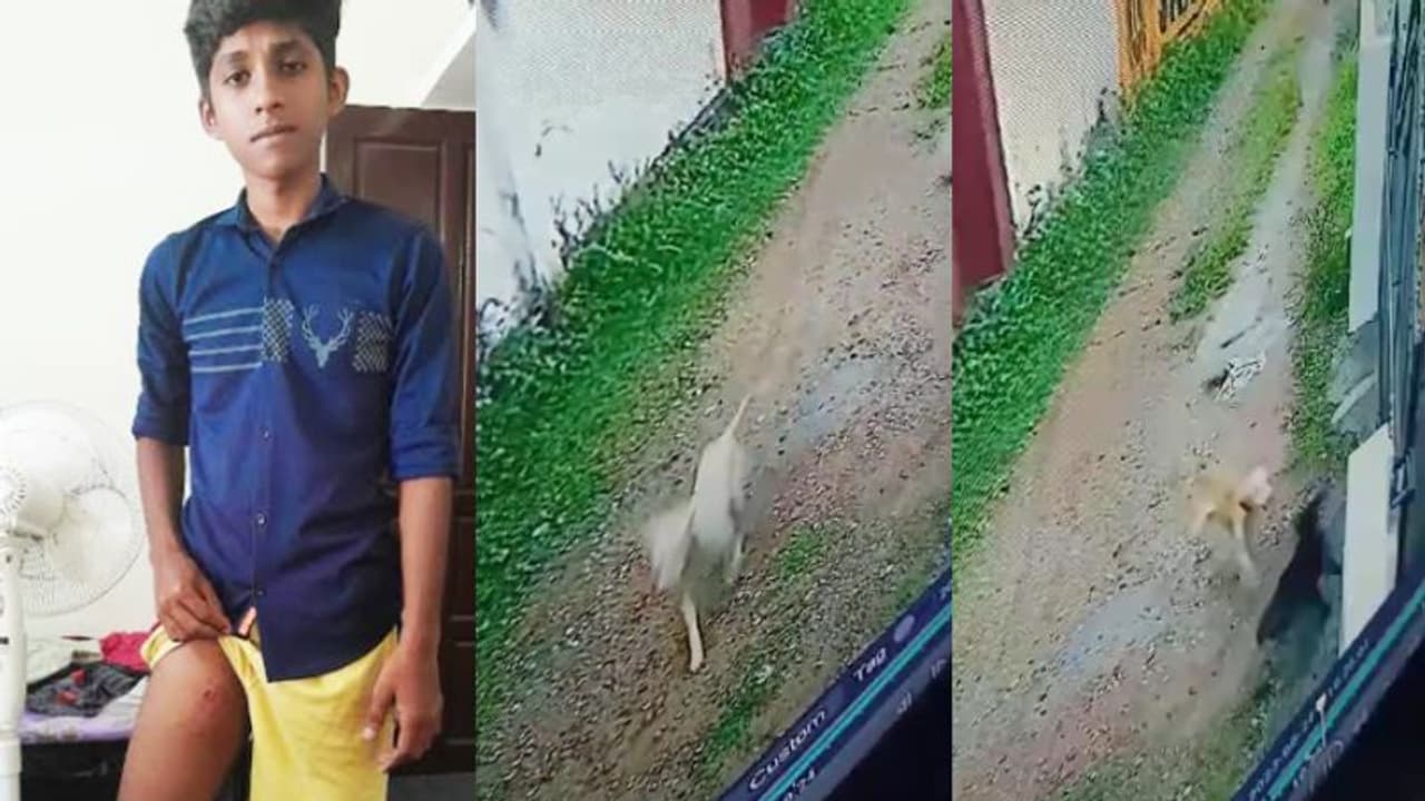 തിരുവനന്തപുരത്ത് വീടിനകത്തുനിന്ന 15 കാരനെ അടക്കം 15 പേരെ തെരുവനായ കടിച്ചു