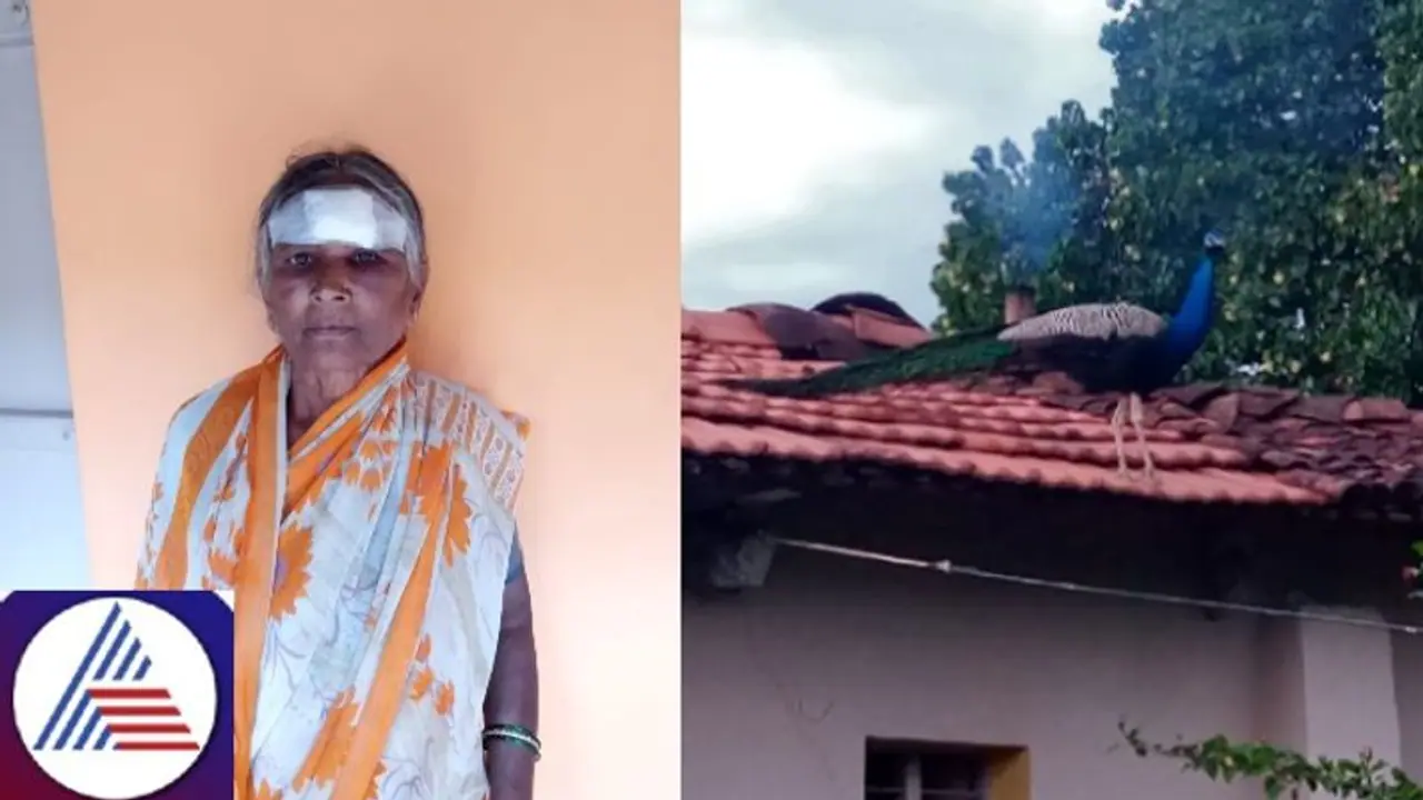 Karnataka: Peacock attacks woman in Chennapattana; receives severe injuries on forehead, eyes Karnataka: Peacock attacks woman in Chennapattana; receives severe injuries on forehead, eyes
