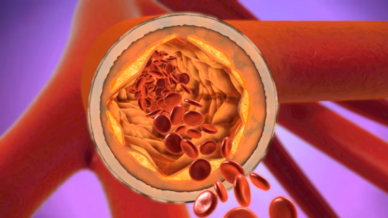  ഉയർന്ന കൊളസ്ട്രോളിനോട് വിട പറയാന്‍ ഈ ഭക്ഷണങ്ങള്‍ കഴിക്കാം... 