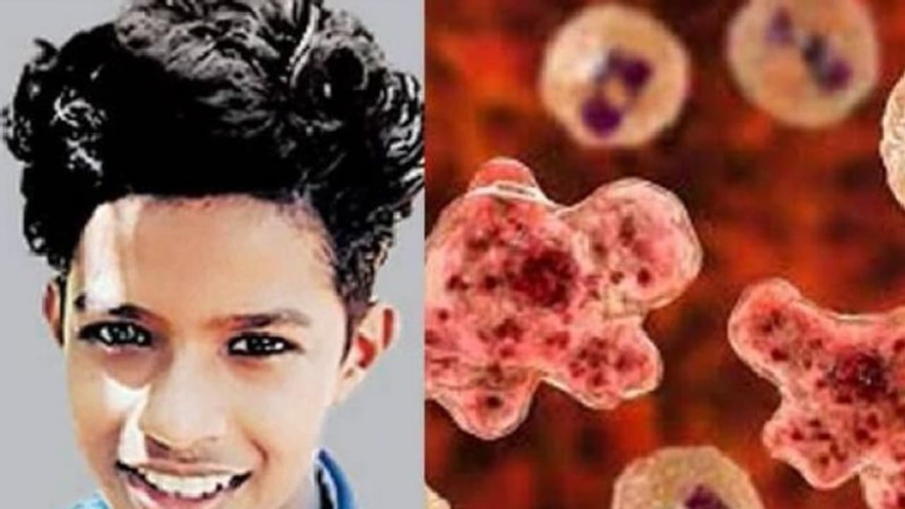 ನದಿಯಲು ಈಜಲು ಹೋಗಿದ್ದ ಬಾಲಕ ಸಾವು, ದೇಹ ಸೇರಿ ಮೆದುಳನ್ನೇ ತಿಂದಿತ್ತು ಆ ಜೀವಿ; ಏನಿದು ವಿಚಿತ್ರ ಸೋಂಕು? ನದಿಯಲು ಈಜಲು ಹೋಗಿದ್ದ ಬಾಲಕ ಸಾವು, ದೇಹ ಸೇರಿ ಮೆದುಳನ್ನೇ ತಿಂದಿತ್ತು ಆ ಜೀವಿ; ಏನಿದು ವಿಚಿತ್ರ ಸೋಂಕು?