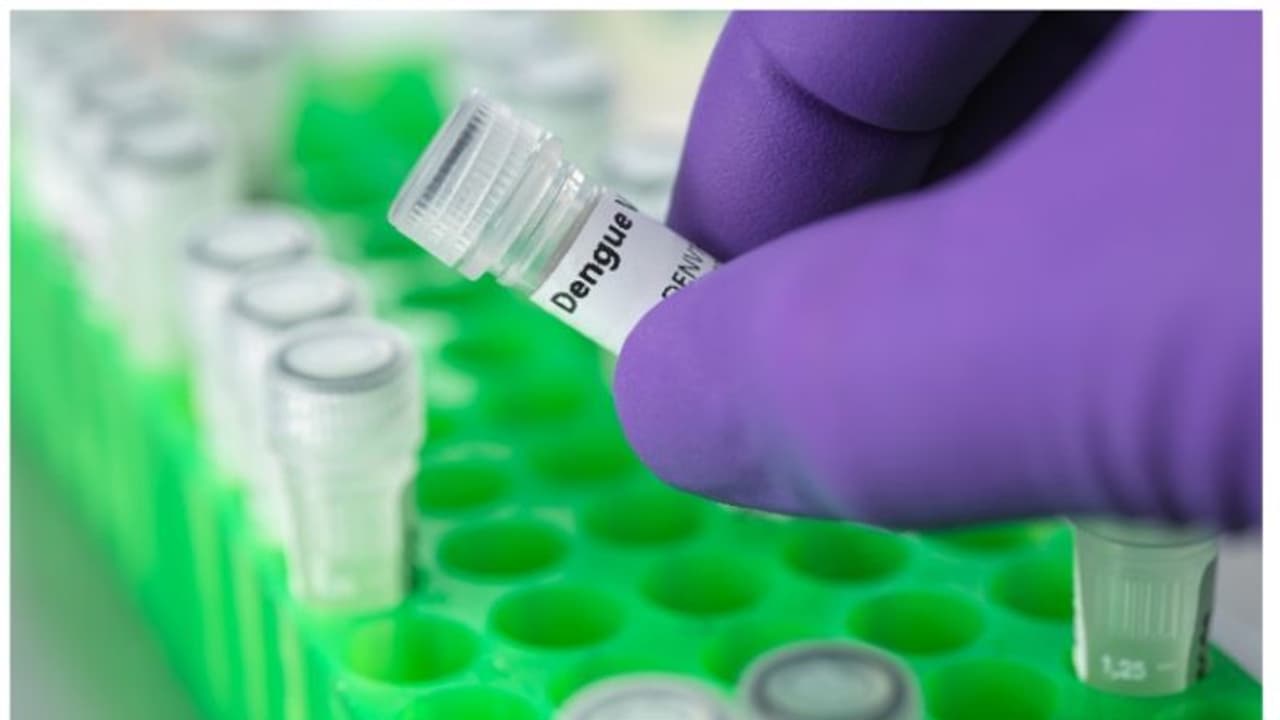 അന്തരീക്ഷത്തിൽ ചൂട് കൂടുന്നത് അപകടം; ഡെങ്കിപ്പനിയെ കുറിച്ച് ആർജിസിബിയുടെ ഞെട്ടിക്കുന്ന പഠനം അന്തരീക്ഷത്തിൽ ചൂട് കൂടുന്നത് അപകടം; ഡെങ്കിപ്പനിയെ കുറിച്ച് ആർജിസിബിയുടെ ഞെട്ടിക്കുന്ന പഠനം