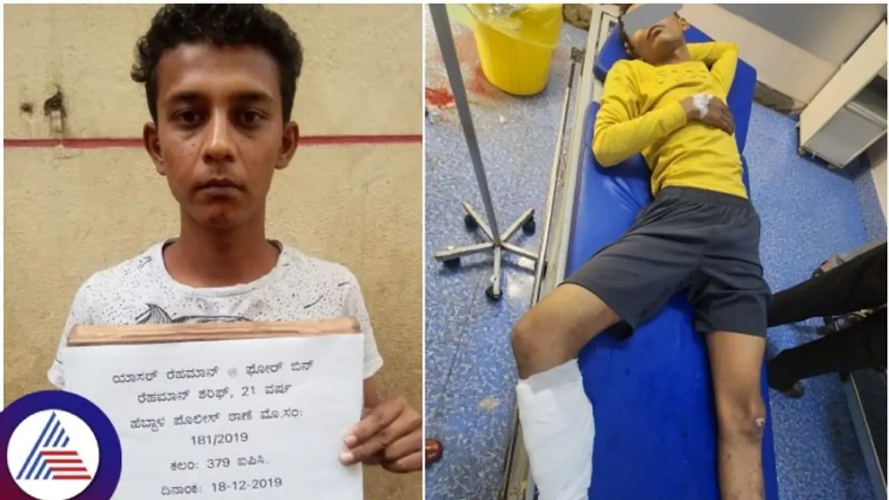 Bengaluru: ಒಂದೂವರೆ ವರ್ಷದ ಬಳಿಕ ಪೊಲೀಸರ ಪಿಸ್ತೂಲ್ ಸದ್ದು: ದರೋಡೆಕೋರನ ಕಾಲಿಗೆ ಗುಂಡೇಟು