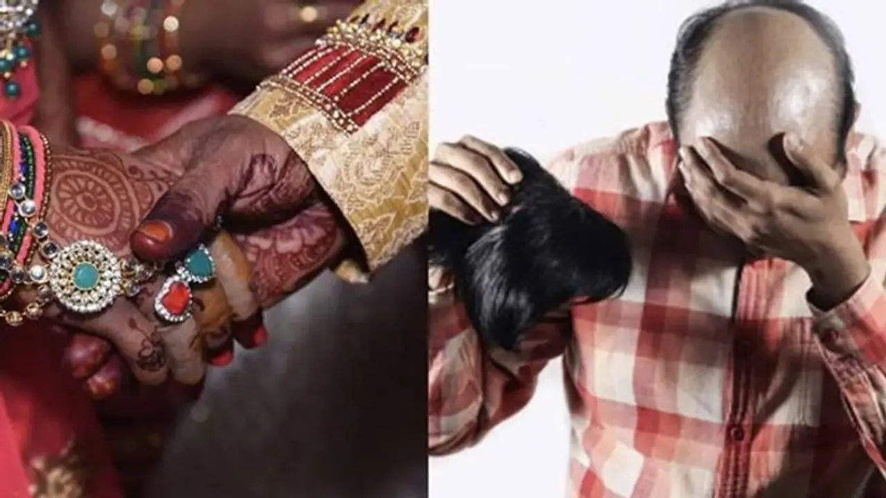 ವಿಗ್ ಹಾಕ್ಕೊಂಡು ಎರಡನೇ ಮದ್ವೆಯಾಗಲು ಬಂದಿದ್ದ ವರ, ಬೋಳು ತಲೆ ನೋಡಿ ತಲೆಸುತ್ತಿ ಬಿದ್ದ ವಧು! ವಿಗ್ ಹಾಕ್ಕೊಂಡು ಎರಡನೇ ಮದ್ವೆಯಾಗಲು ಬಂದಿದ್ದ ವರ, ಬೋಳು ತಲೆ ನೋಡಿ ತಲೆಸುತ್ತಿ ಬಿದ್ದ ವಧು!