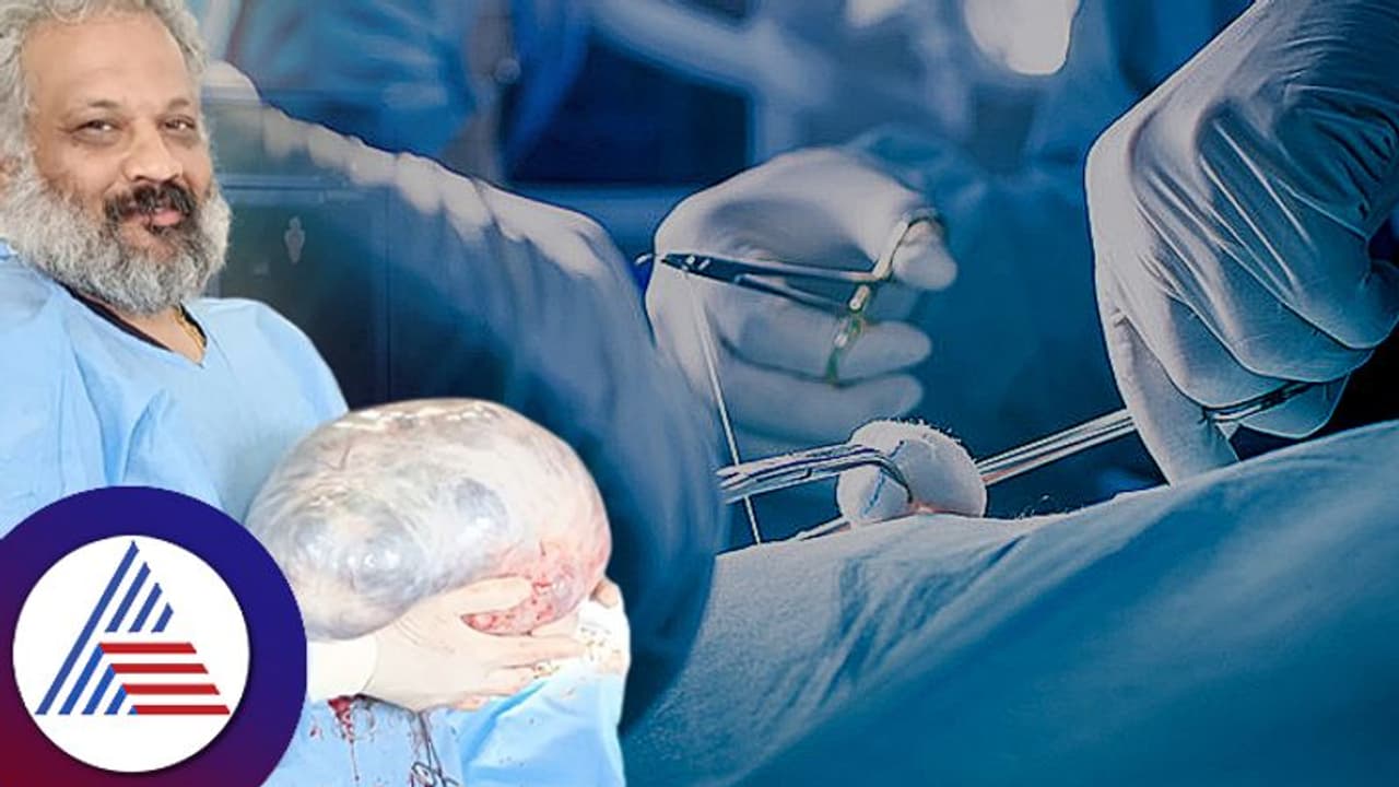 ಮಹಿಳೆಯ ಹೊಟ್ಟೆ ಸ್ಕ್ಯಾನ್ ಮಾಡಿದಾಗ ಕಾದಿತ್ತು ಅಚ್ಚರಿ: 11 ಕೆ.ಜಿ ತೂಕದ ಗೆಡ್ಡೆ ಹೊರ ತೆಗೆದ ವೈದ್ಯರು ಮಹಿಳೆಯ ಹೊಟ್ಟೆ ಸ್ಕ್ಯಾನ್ ಮಾಡಿದಾಗ ಕಾದಿತ್ತು ಅಚ್ಚರಿ: 11 ಕೆ.ಜಿ ತೂಕದ ಗೆಡ್ಡೆ ಹೊರ ತೆಗೆದ ವೈದ್ಯರು