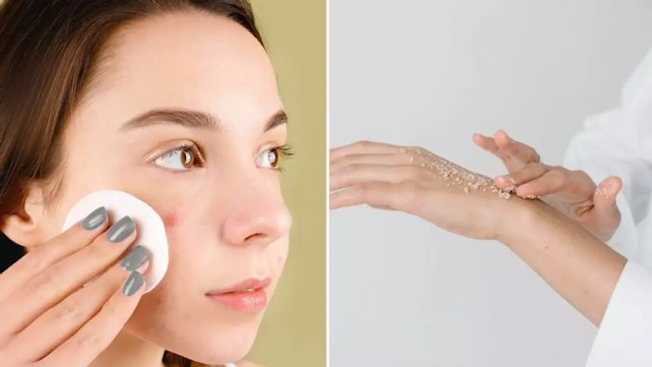 Cleansing to Exfoliating: 7 skin care tips for Oily Skin during Monsoons