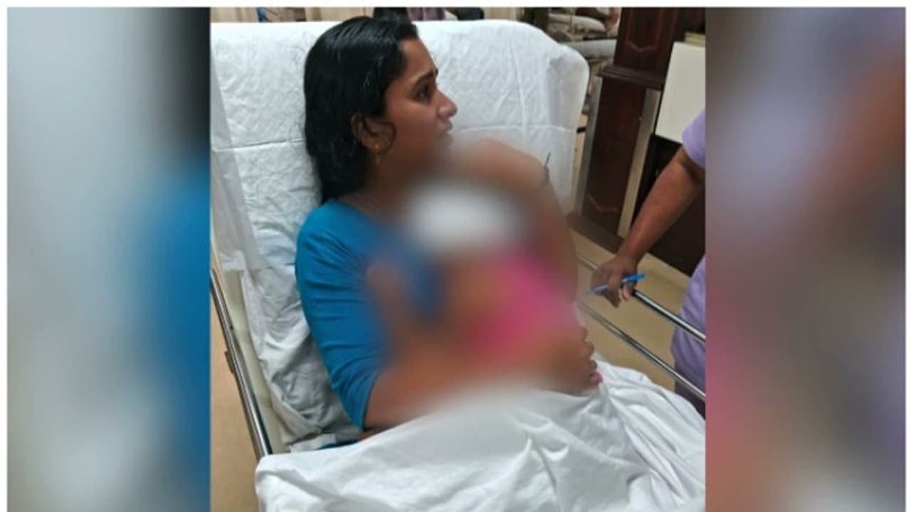  മൂന്നു വയസ്സുകാരിയെ തെരുവുനായ് ആക്രമിച്ചു; കുഞ്ഞിന്റെ മുഖത്ത് ​ഗുരുതര പരിക്ക്