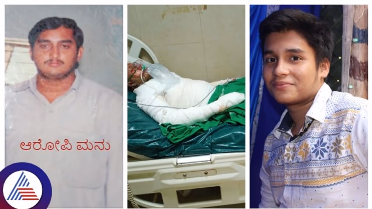 Karnataka shocker! Man elopes with family after setting cousin on fire for loving his daughter Karnataka shocker! Man elopes with family after setting cousin on fire for loving his daughter