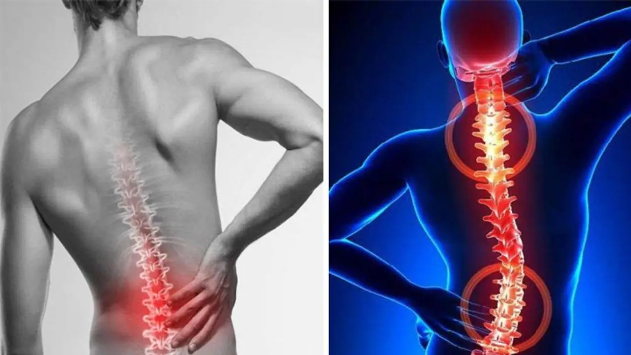 Health Tips: ಬೆನ್ನುನೋವಾ? ನಿಮ್ಮ ಥೋರಾಸಿಕ್ ಬೆನ್ನುಮೂಳೆ ಹಾನಿಗೆ ಒಳಗಾಗಿರ್ಬೋದು ಎಚ್ಚರ Health Tips: ಬೆನ್ನುನೋವಾ? ನಿಮ್ಮ ಥೋರಾಸಿಕ್ ಬೆನ್ನುಮೂಳೆ ಹಾನಿಗೆ ಒಳಗಾಗಿರ್ಬೋದು ಎಚ್ಚರ