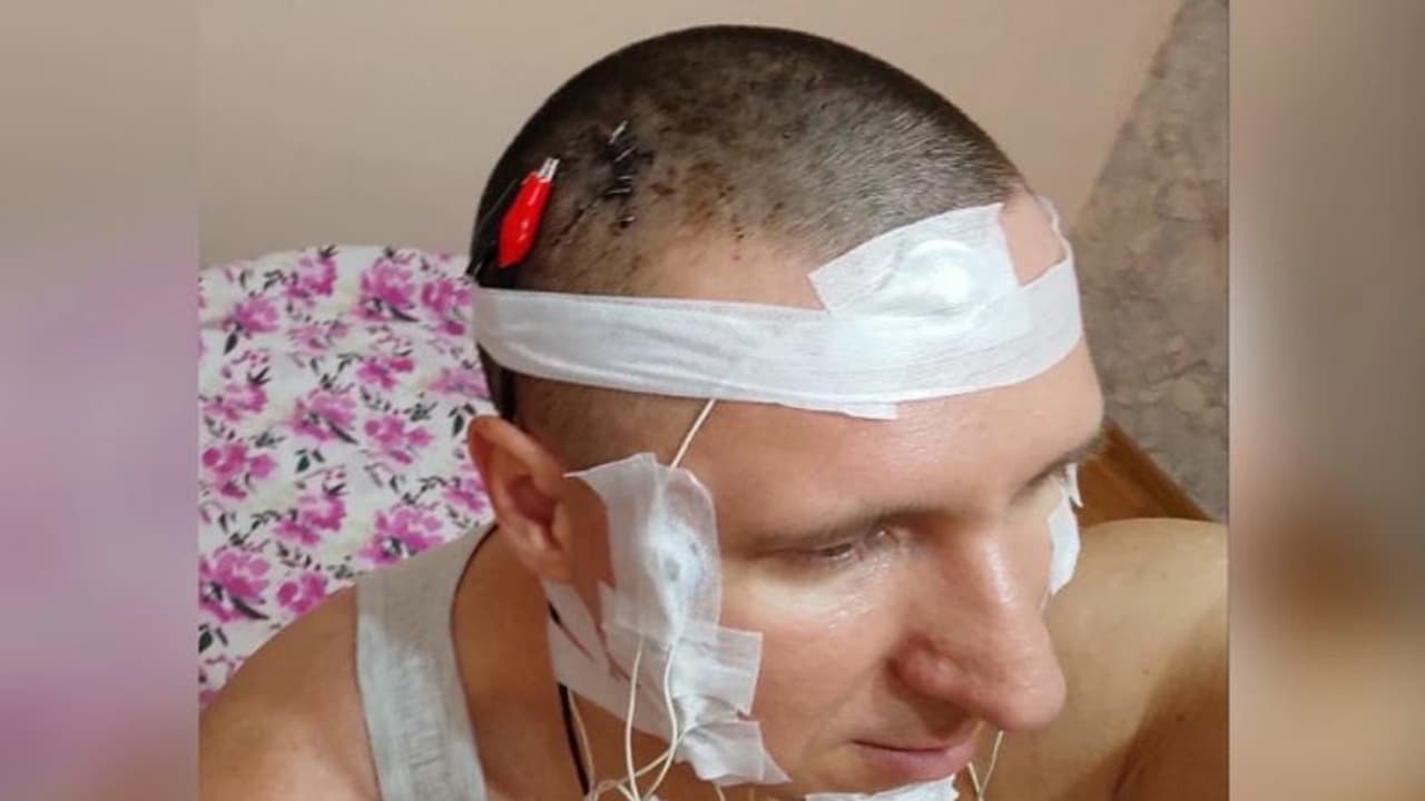 ഡ്രില്ലര് വച്ച് തല തുളച്ച് സ്വന്തമായി തലച്ചോറില് ശസ്ത്രക്രിയ!; ഇത് ചെയ്തതിന് പിന്നിലൊരു കാരണവുമുണ്ട് ഡ്രില്ലര് വച്ച് തല തുളച്ച് സ്വന്തമായി തലച്ചോറില് ശസ്ത്രക്രിയ!; ഇത് ചെയ്തതിന് പിന്നിലൊരു കാരണവുമുണ്ട്