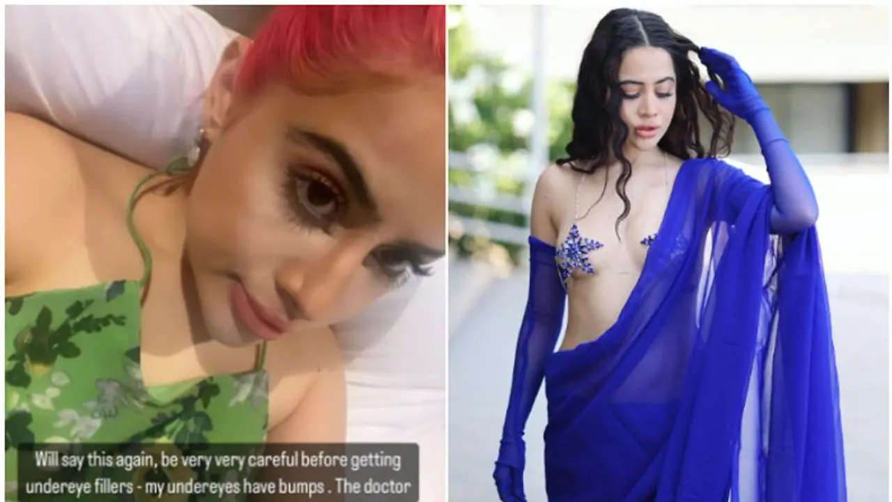 Uorfi Javed opens up about her plastic surgery, warns followers to be careful 