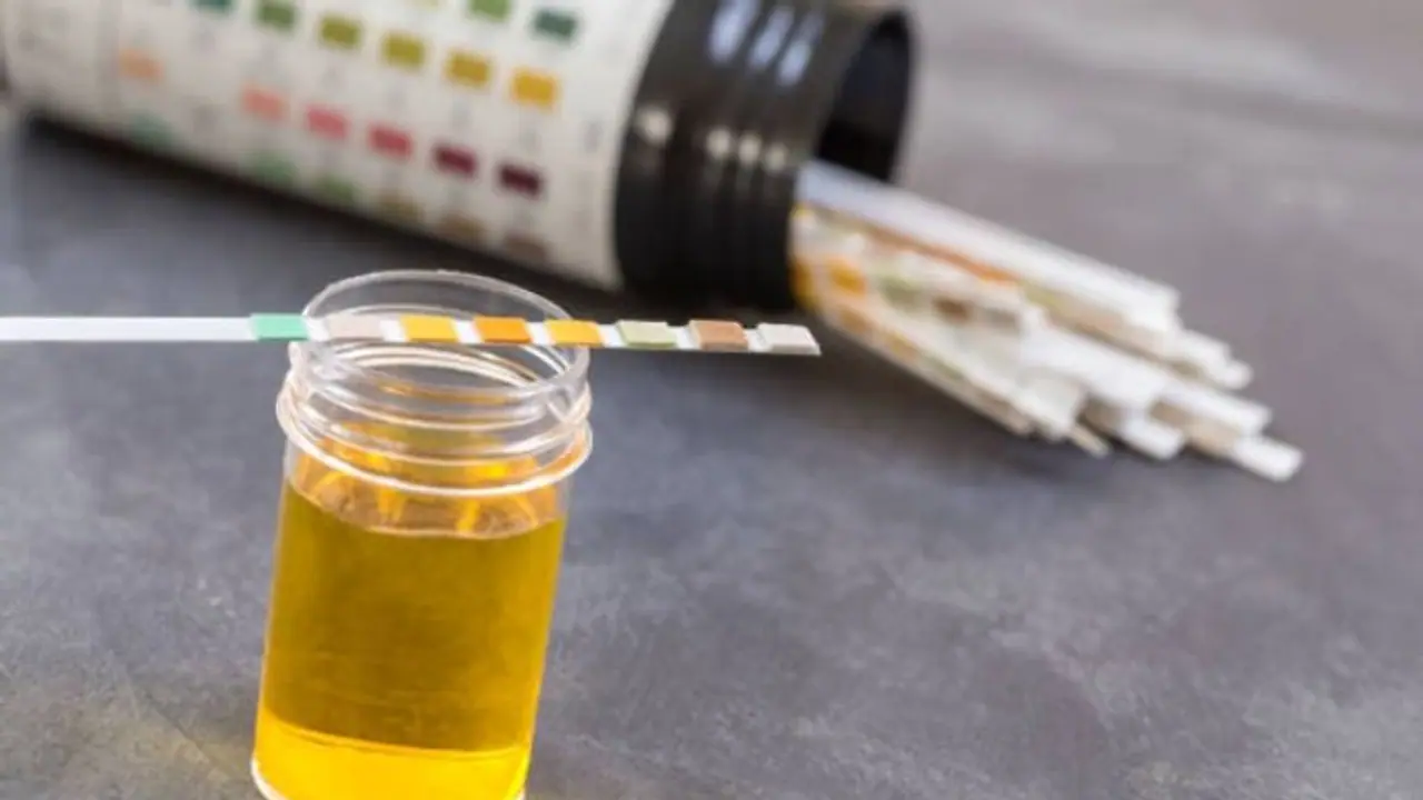 குளிர்காலத்தில் கூட சிறுநீர் மஞ்சள் நிறத்தில் போகுதா? தீவிர நோய்களைக் குறிக்கும்..ஜாக்கிரதை!