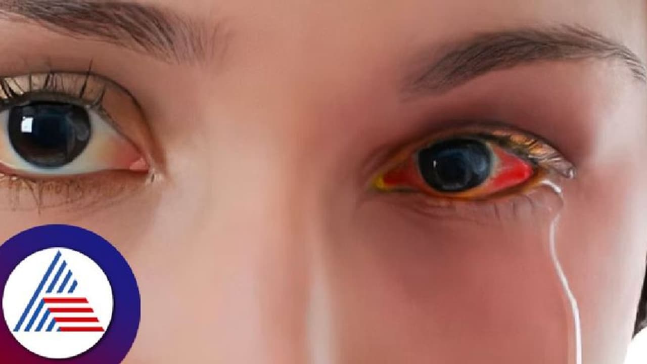 ದಾವಣಗೆರೆಯಲ್ಲಿ ಹೆಚ್ಚಾದ ಮಳೆ, ಮಕ್ಕಳಲ್ಲಿ ಕಾಣಿಸಿಕೊಳ್ಳುತ್ತಿದೆ ಕಣ್ಣಿನ ವೈರಸ್ ಸಮಸ್ಯೆ