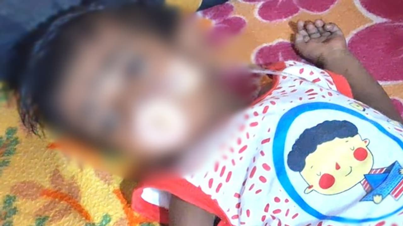 ഒരു വയസുകാരൻ ദേവന് ഹൃദയത്തിനും ശ്വാസകോശത്തിനും ഗുരുതര രോഗം, രണ്ട് ശസ്ത്രക്രിയ വേണം, സഹായം തേടി കുടുംബം