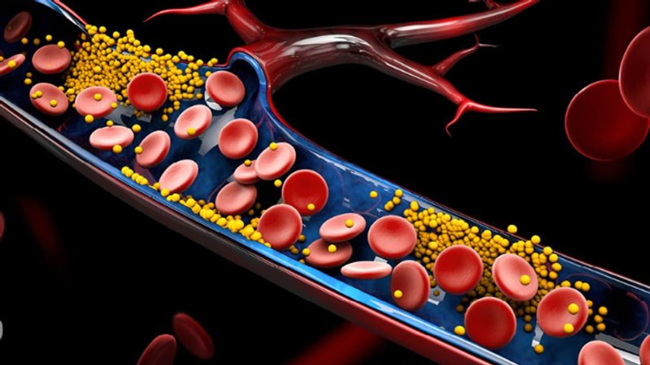 ചീത്ത കൊളസ്ട്രോൾ കുറയ്ക്കാൻ ഇവ കഴിക്കാം ചീത്ത കൊളസ്ട്രോൾ കുറയ്ക്കാൻ ഇവ കഴിക്കാം