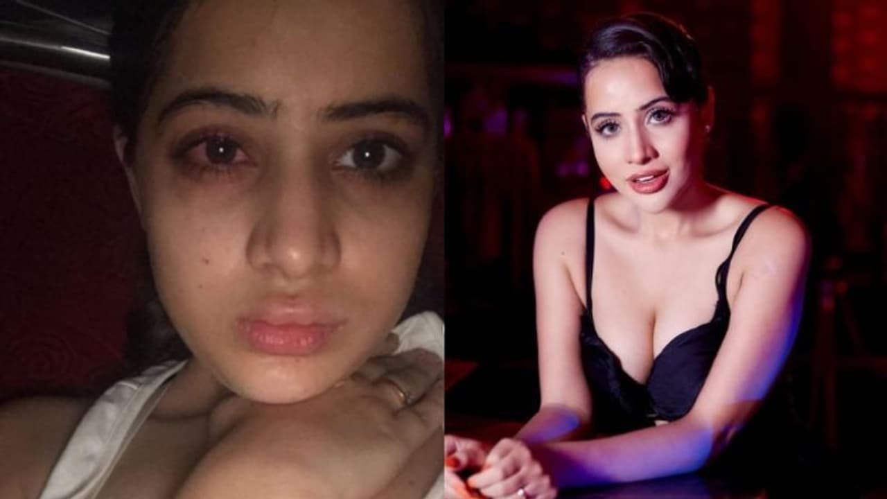 ലിപ് ഫില്ലര് ചെയ്ത ശേഷം സംഭവിച്ചത്; ചിത്രങ്ങള് പങ്കിട്ട് മുന്നറിയിപ്പുമായി ഉര്ഫി ലിപ് ഫില്ലര് ചെയ്ത ശേഷം സംഭവിച്ചത്; ചിത്രങ്ങള് പങ്കിട്ട് മുന്നറിയിപ്പുമായി ഉര്ഫി