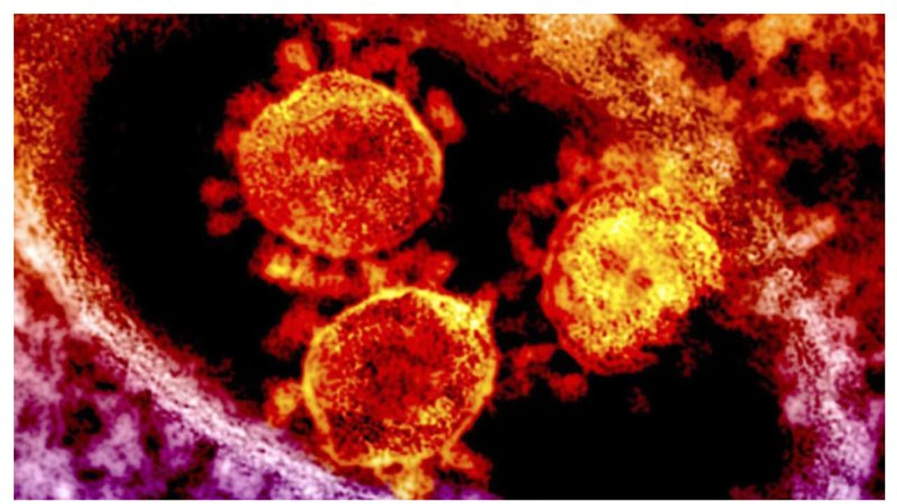 യുഎഇയില് മെര്സ് വൈറസ് സ്ഥിരീകരിച്ചു യുഎഇയില് മെര്സ് വൈറസ് സ്ഥിരീകരിച്ചു