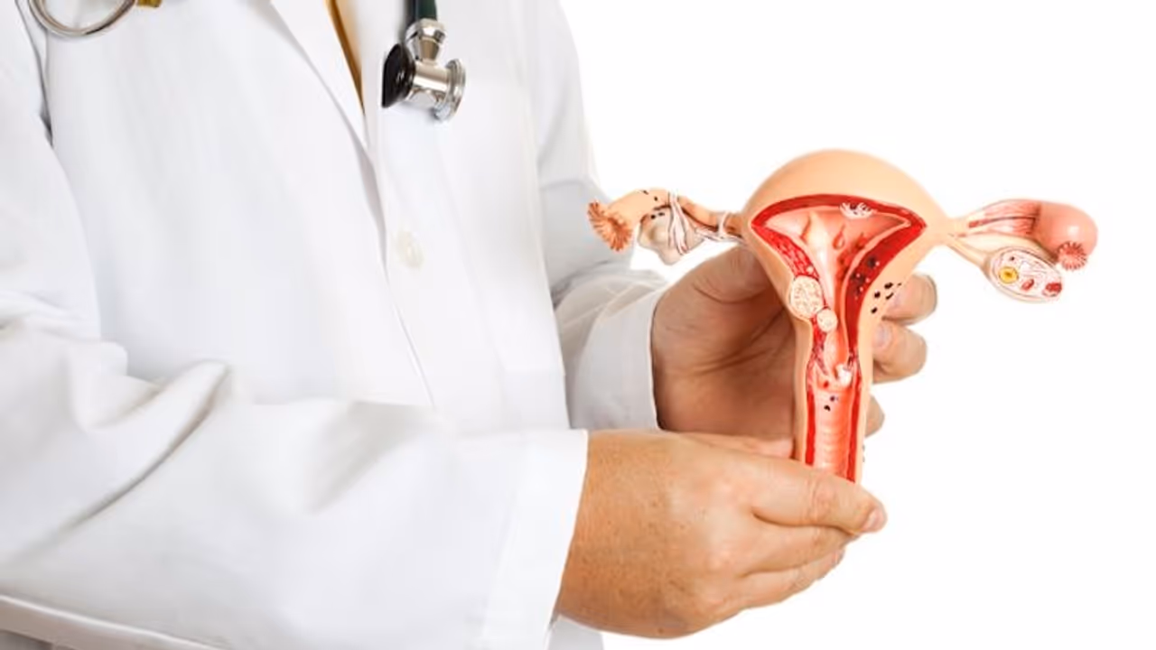 What is 'Uterine fibroids'? Busting myths related to non cancerous growth in the uterus
