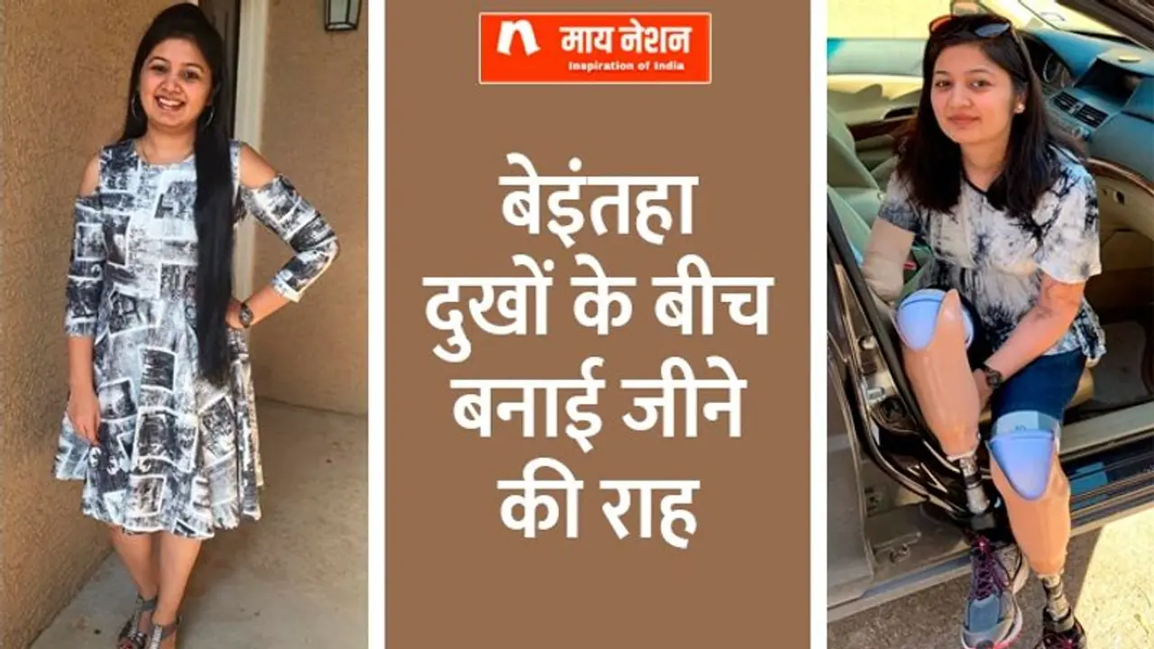 धरा को सैल्यूटः बेटा जन्‍मा, कोमा में गईं बच्चेदानी निकालनी पड़ी, हाथ पैर कटे, अब हैं सोशल मीडिया इन्फ्लुएंसर