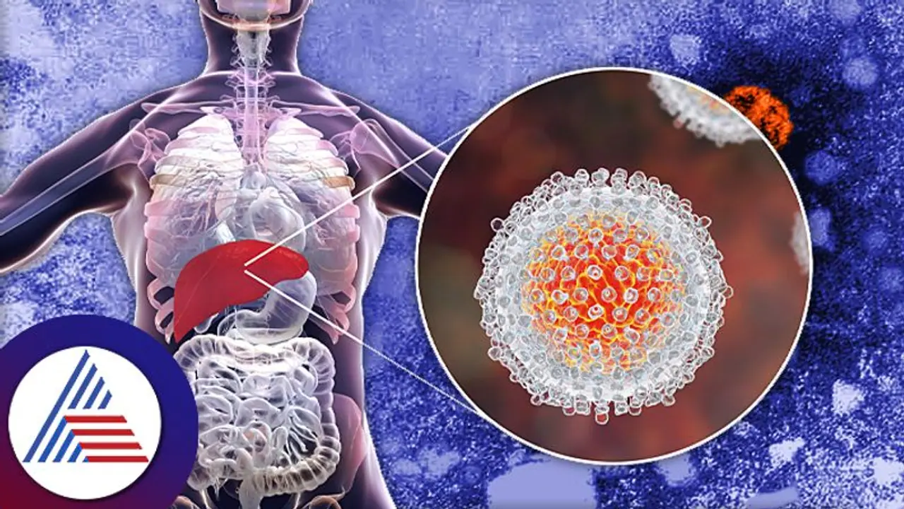 Health Tips: ಹೆಪಟೈಟಿಸ್ ಸೋಂಕು ಹೇಗೆ ಲಿವರ್ ಹಾಳು ಮಾಡುತ್ತೆ? ಜಗತ್ತನ್ನೇ ಕಾಡ್ತಾ ಇರೋ ರೋಗದ ಬಗ್ಗೆ ಎಚ್ಚರ! Health Tips: ಹೆಪಟೈಟಿಸ್ ಸೋಂಕು ಹೇಗೆ ಲಿವರ್ ಹಾಳು ಮಾಡುತ್ತೆ? ಜಗತ್ತನ್ನೇ ಕಾಡ್ತಾ ಇರೋ ರೋಗದ ಬಗ್ಗೆ ಎಚ್ಚರ!