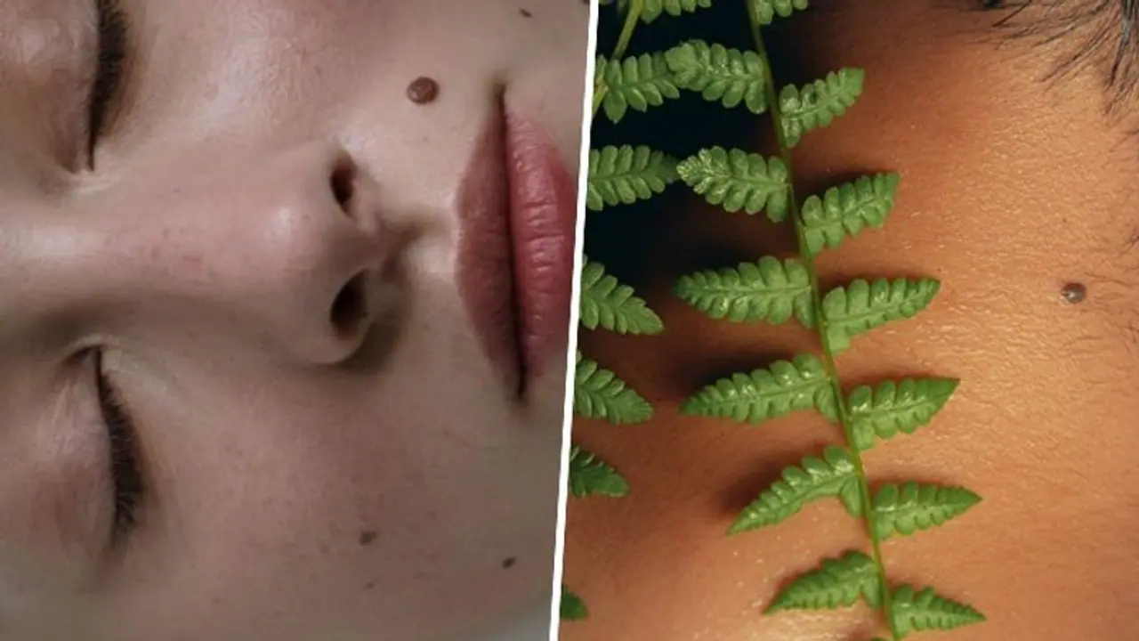 Unusual moles on your body? Here are 6 things which demands attention Unusual moles on your body? Here are 6 things which demands attention