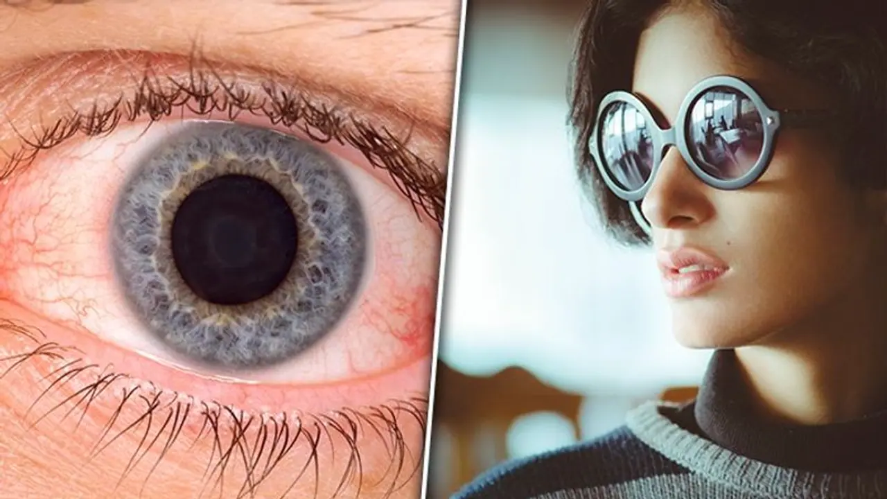 Conjunctivitis alert: 'Kala Chasma' no remedy to prevent spread; doctors urge caution amid Delhi epidemic Conjunctivitis alert: 'Kala Chasma' no remedy to prevent spread; doctors urge caution amid Delhi epidemic