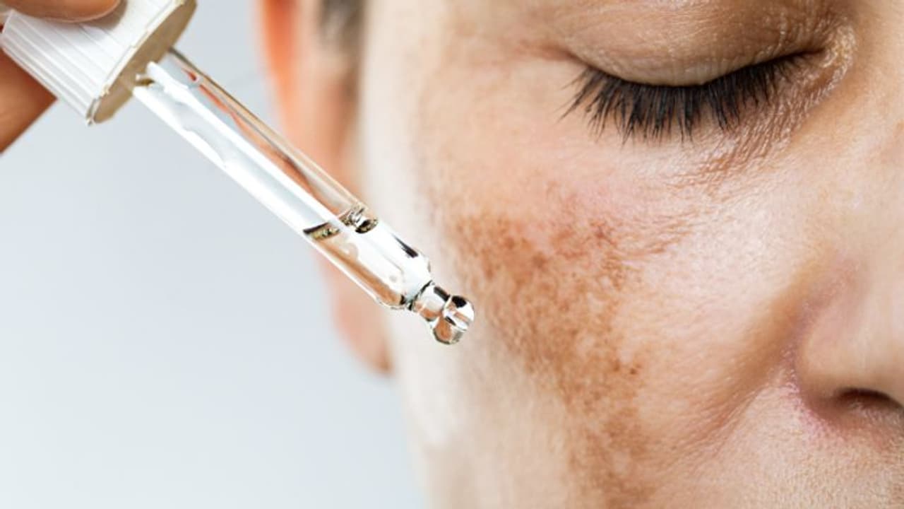 മുഖത്തെ ഇരുണ്ട പാടുകള് അലട്ടുന്നുണ്ടോ? അടുക്കളയിലേയ്ക്ക് പോകൂ, അവിടെയുണ്ട് പരിഹാരം... മുഖത്തെ ഇരുണ്ട പാടുകള് അലട്ടുന്നുണ്ടോ? അടുക്കളയിലേയ്ക്ക് പോകൂ, അവിടെയുണ്ട് പരിഹാരം...