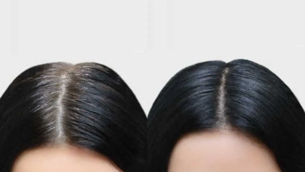 ചെറുപ്പത്തിലുള്ള അകാലനരയെ തടയാം; ഡയറ്റില്‍ ഉള്‍പ്പെടുത്താം ഈ ഏഴ് ഭക്ഷണങ്ങള്‍...