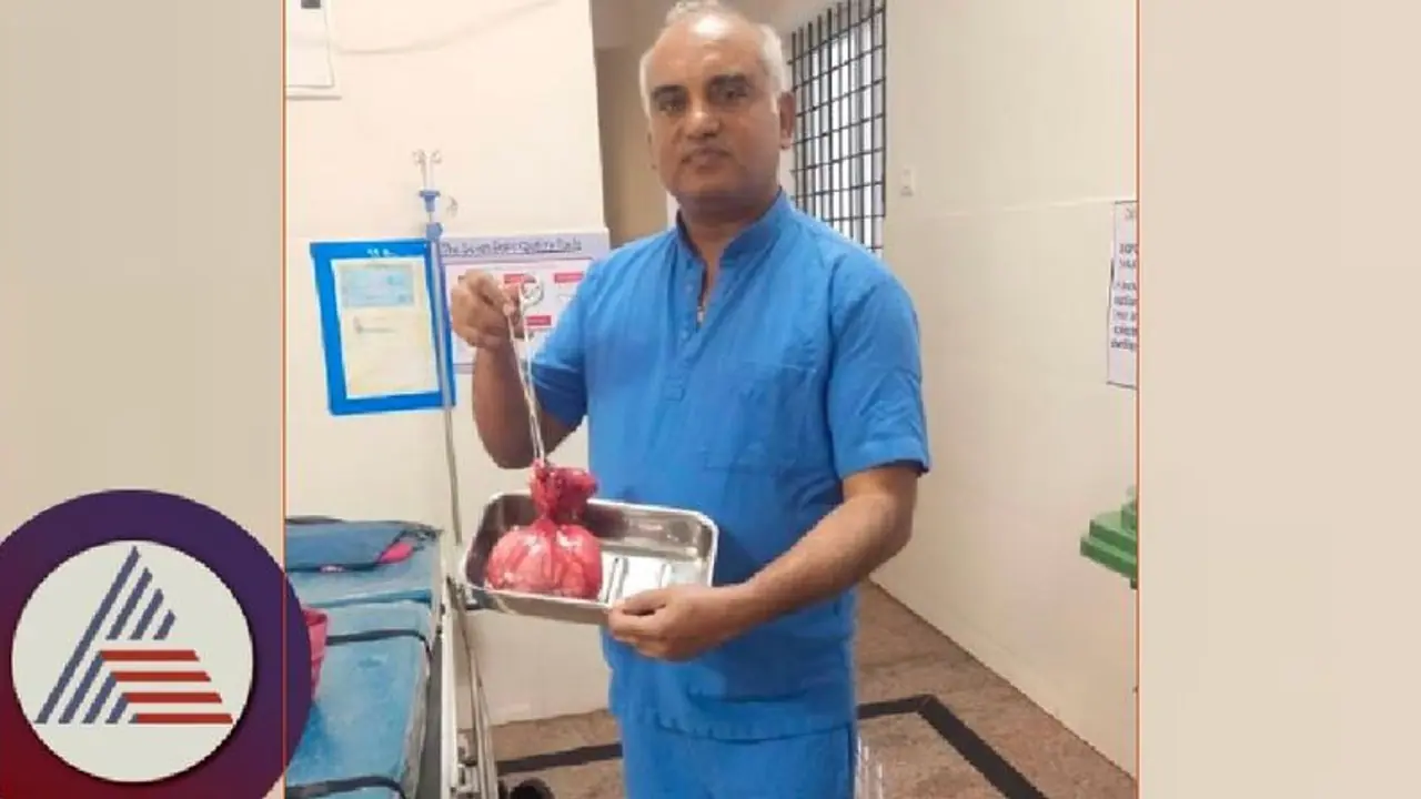 ಮಹಿಳೆ ಹೊಟ್ಟೆಯಲ್ಲಿದ್ದ ಬರೋಬ್ಬರಿ 2.5 ಕೆ.ಜಿ. ತೂಕದ ಗಡ್ಡೆ ಹೊರ ತೆಗೆದ ವೈದ್ಯರು! 