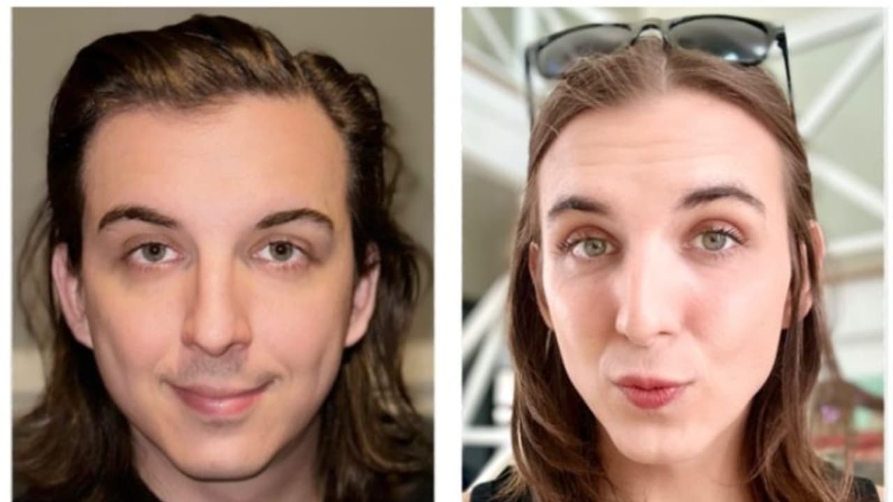 ആറ് മാസത്തെ ഹോര്മോണ് ചികിത്സയ്ക്ക് ശേഷം ചിത്രങ്ങള് പങ്കുവച്ച് ക്രിസ് ടൈസണ്; സമ്മിശ്ര പ്രതികരണം! ആറ് മാസത്തെ ഹോര്മോണ് ചികിത്സയ്ക്ക് ശേഷം ചിത്രങ്ങള് പങ്കുവച്ച് ക്രിസ് ടൈസണ്; സമ്മിശ്ര പ്രതികരണം!