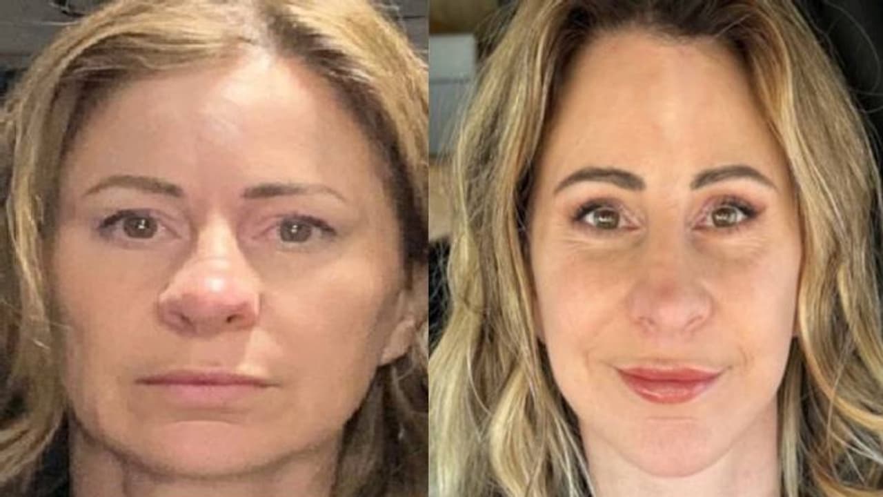 ചെറുപ്പമായിരിക്കാൻ സർജറി, ചെലവ് കണ്ടെത്താൻ വീടുവിറ്റ് താമസം വാനിലേക്ക് മാറ്റി 50 കാരി