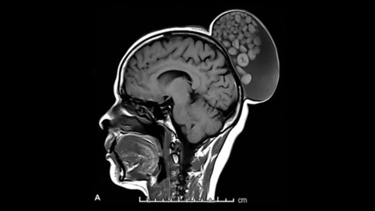 Bengaluru : பெண்ணின் உச்சந்தலையில் வளர்ந்த கட்டி.. அறுவை சிகிச்சையை வெற்றிகரமாக முடித்த மருத்துவர்கள் Bengaluru : பெண்ணின் உச்சந்தலையில் வளர்ந்த கட்டி.. அறுவை சிகிச்சையை வெற்றிகரமாக முடித்த மருத்துவர்கள்