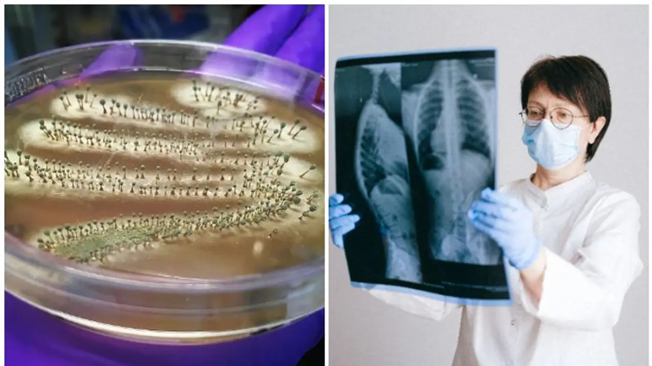 Penicillin to X rays: 7 groundbreaking discoveries in Medical Science that revolutionized healthcare