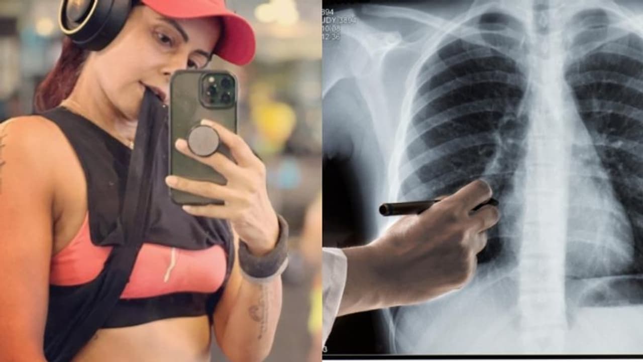 ക്യാൻസര്‍ ബാധിച്ചതിന് ശേഷം വീണ്ടും ഒരസുഖം കൂടി; വിവരങ്ങള്‍ പങ്കിട്ട് നടി ഛവി മിത്തല്‍