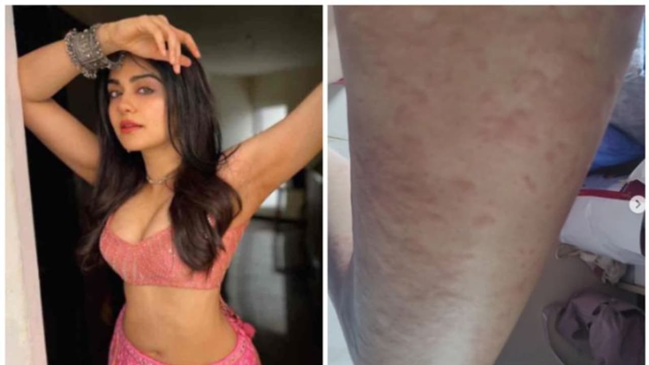 ബാധിച്ച രോഗത്തിന്റെ ചിത്രങ്ങള് പങ്കുവച്ചു; പിന്നാലെ കേരള സ്റ്റോറി നായിക ആദാ ശർമ്മ ആശുപത്രിയില് അഡ്മിറ്റായി ബാധിച്ച രോഗത്തിന്റെ ചിത്രങ്ങള് പങ്കുവച്ചു; പിന്നാലെ കേരള സ്റ്റോറി നായിക ആദാ ശർമ്മ ആശുപത്രിയില് അഡ്മിറ്റായി