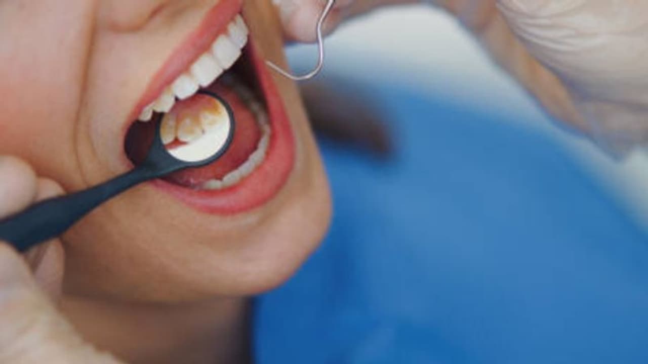 പല്ലില് പോട് വരാനും പല്ല് നശിക്കാനും കാരണമാകുന്ന അഞ്ച് ശീലങ്ങള്... പല്ലില് പോട് വരാനും പല്ല് നശിക്കാനും കാരണമാകുന്ന അഞ്ച് ശീലങ്ങള്...