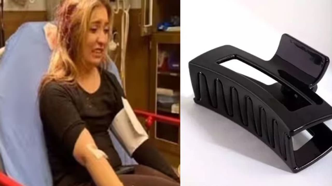 எமனாக மாறிய தலையில் மாட்டிய கிளிப்.. பெண்களே உஷார் வீடியோ போட்டு விளக்கம் கொடுத்த பெண்! எமனாக மாறிய தலையில் மாட்டிய கிளிப்.. பெண்களே உஷார் வீடியோ போட்டு விளக்கம் கொடுத்த பெண்!