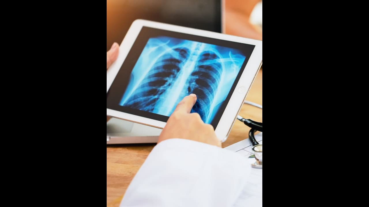 പുകവലി അല്ലാതെ ശ്വാസകോശത്തിലെ ക്യാൻസറിലേക്ക് നയിക്കുന്ന ഘടകങ്ങള്‍...