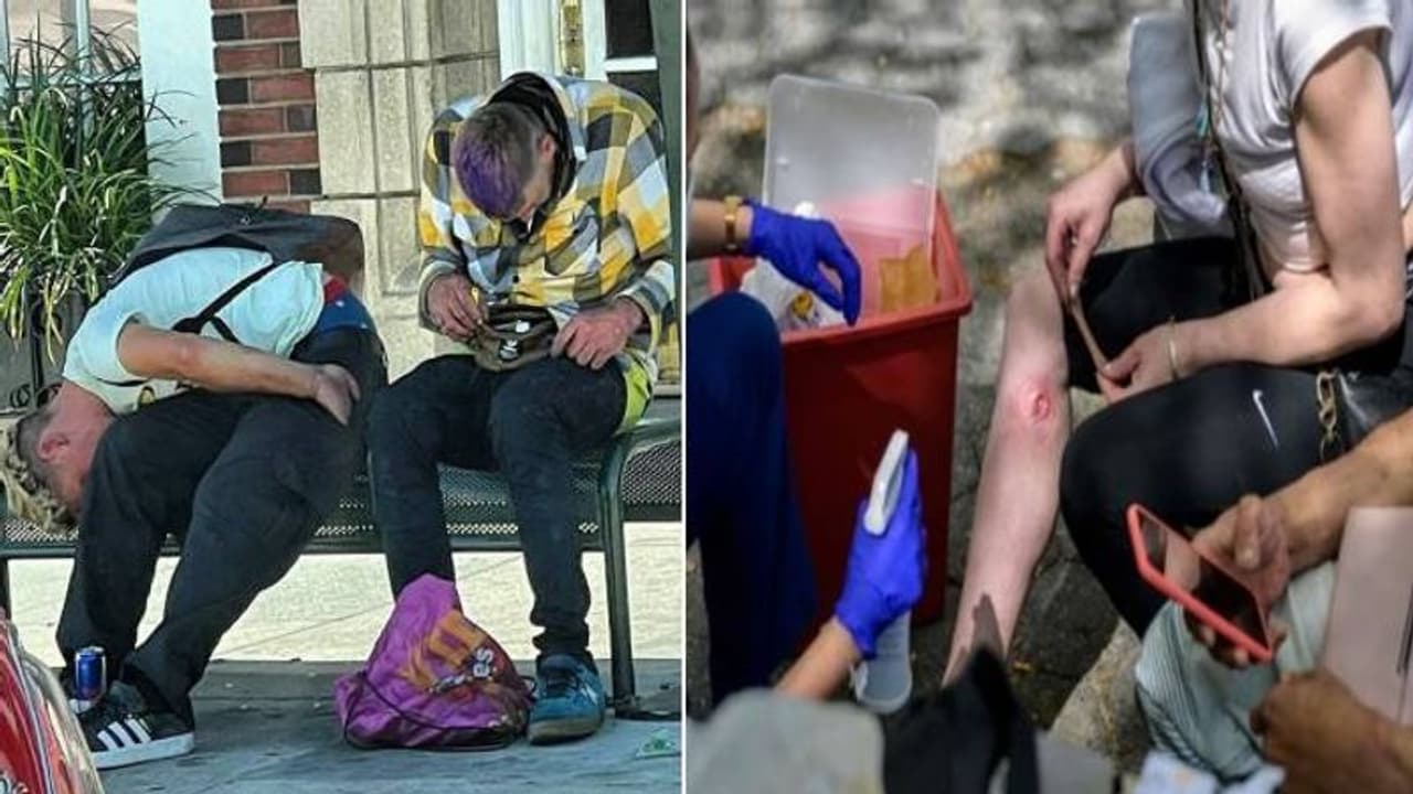 സോംബികളെപ്പോലെ പെരുമാറ്റം, ശരീരം പഴുത്തഴുകും, ആ അവസ്ഥയ്ക്ക് കാരണമെന്ത്? കണ്ടെത്തി, ഈ മരുന്ന്