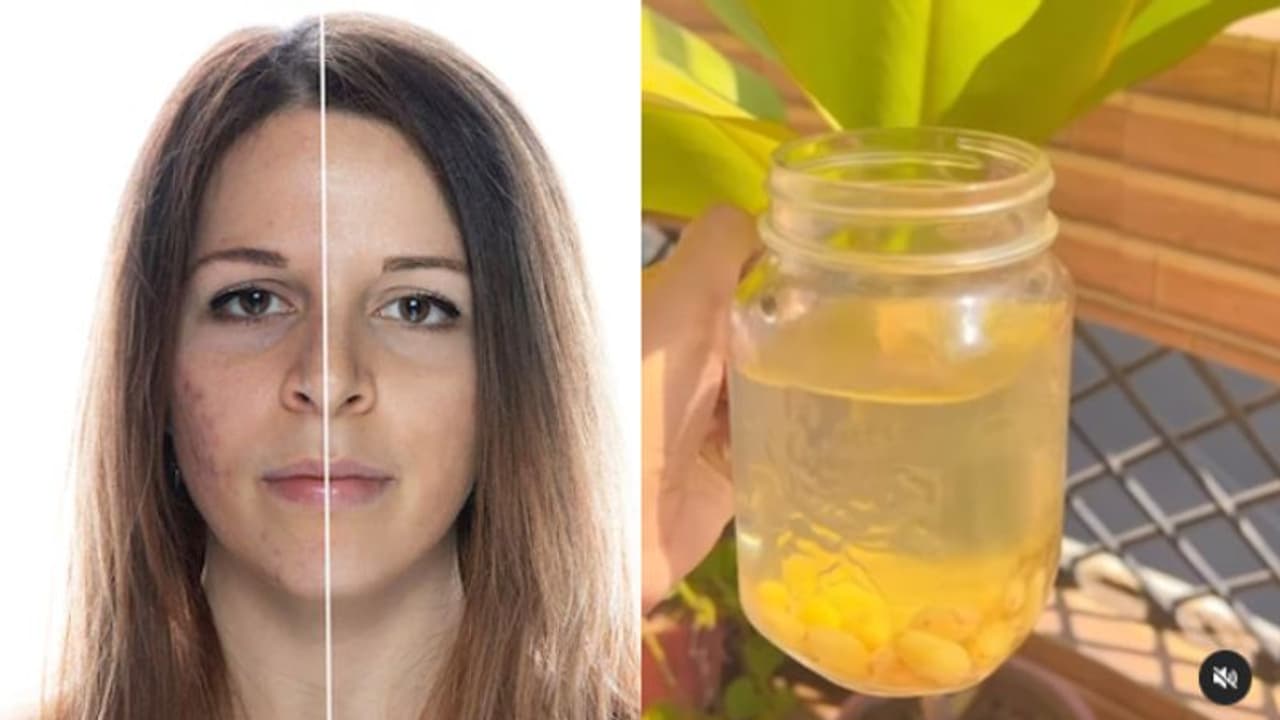  മുഖക്കുരുവിനെ തടയാന്‍ കുതിർത്ത ഉണക്കമുന്തിരി വെള്ളം ഇങ്ങനെ കുടിക്കാം... 